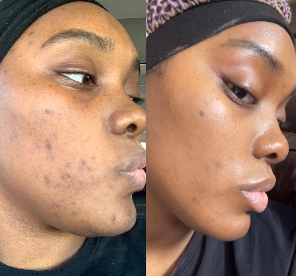 Gamme Visage Éclat - Brightening | 4 Produits Pour Un Teint Uniforme